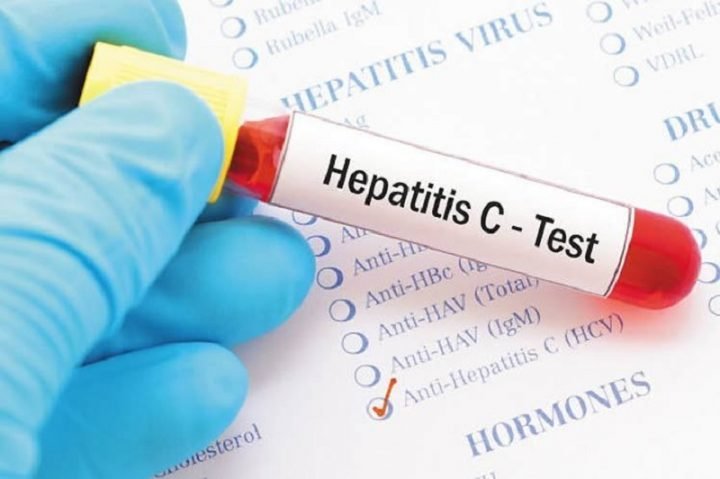 Hepatitis-C-720x479